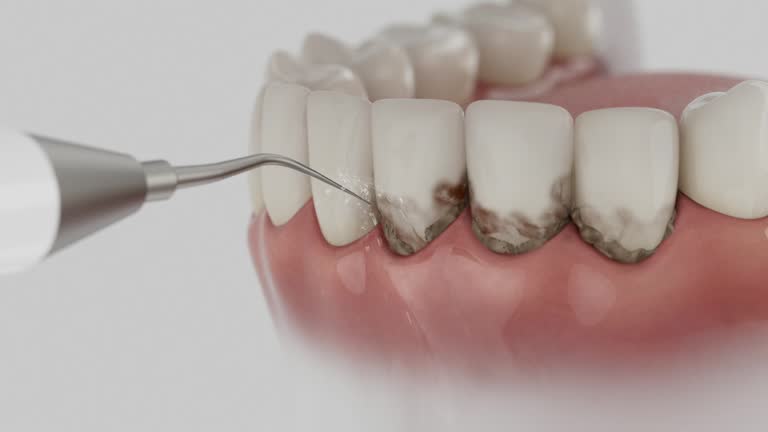 Trusted Invisalign Clear Aligners service in Barbourville, KY - Dentist Open Now